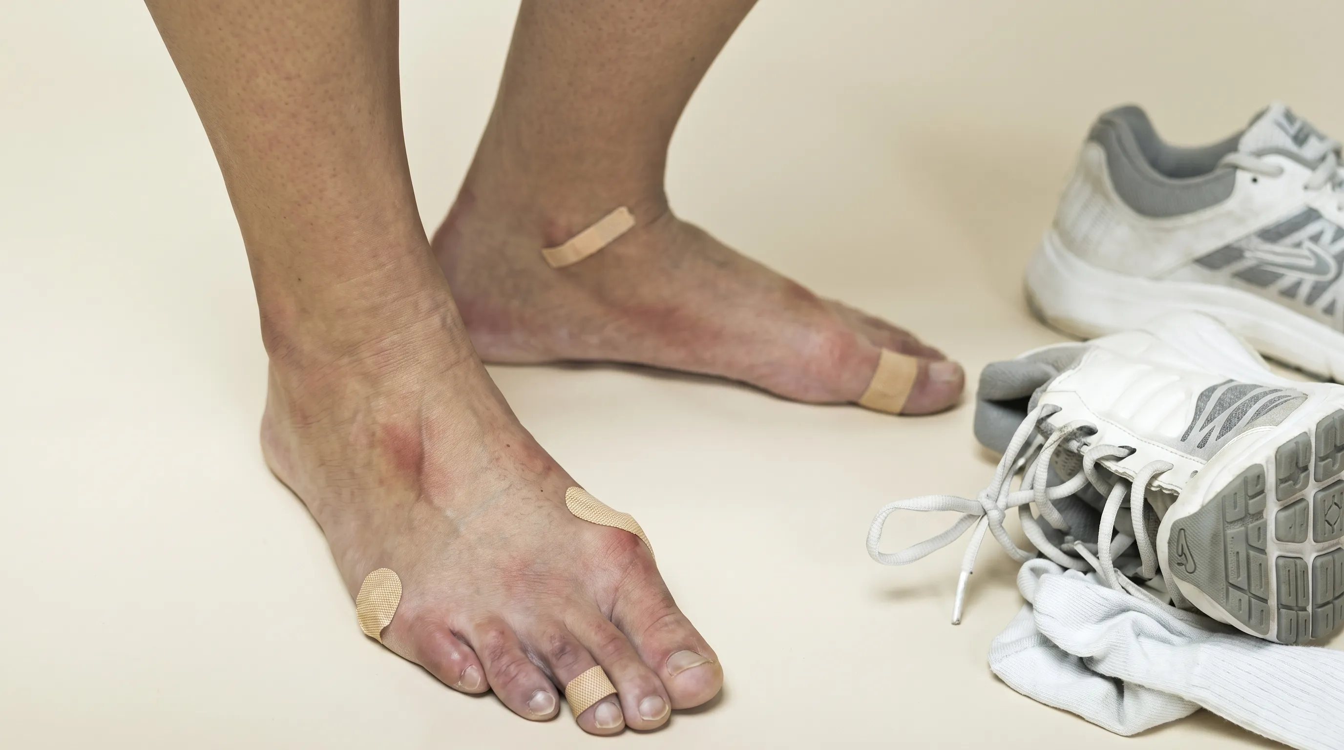 Tratamento de podologia esportiva focado na recuperação e saúde dos pés de atletas